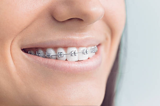 Best Traditional Braces  in Bull Mountain, OR